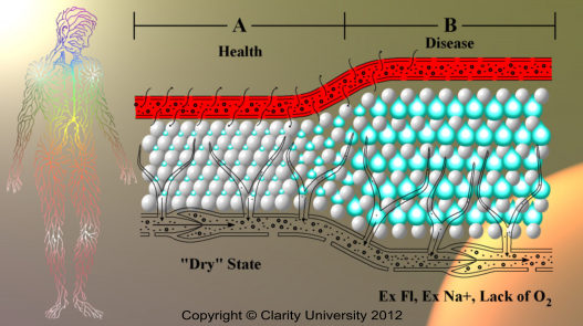 heart attack diagram. disease from